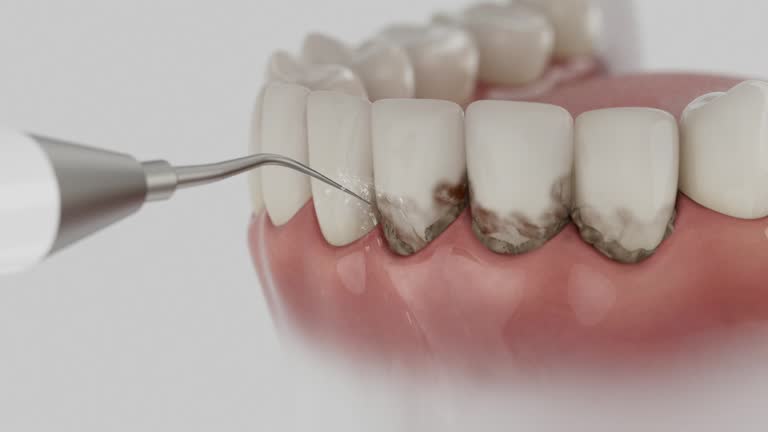 Reliable Dental contractor in Perris, CA by Smile Center Dentistry